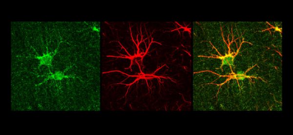 Un nouveau régime pour freiner Alzheimer?