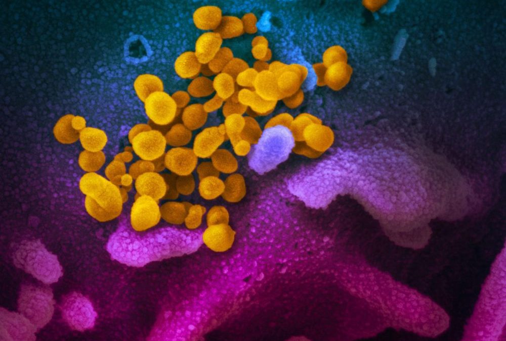 Covid-19 : la version mutée du virus, dite « européenne », est plus infectieuse mais apparemment pas plus dangereuse