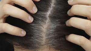 Le stress fait grisonner les cheveux et le phénomène est parfois réversible