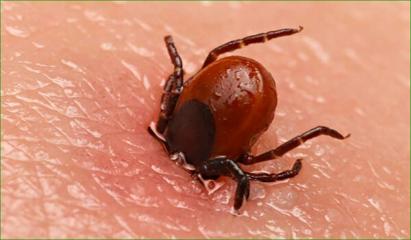 Maladie de Lyme ou Borreliose